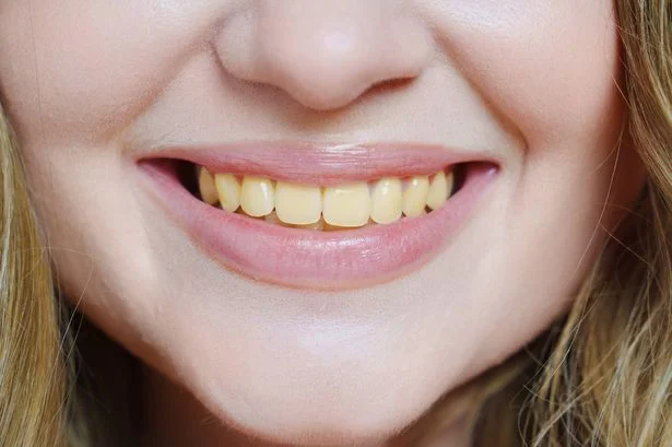 Dentist warns of daily bread habit that may be bad for your teeth